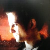 soporte vision systems