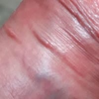 ¿Se trata de una infección?