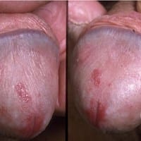 Algún urólogo o alguien que sepa