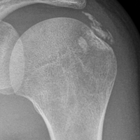 ¿Qué ven ustedes en esa placa?