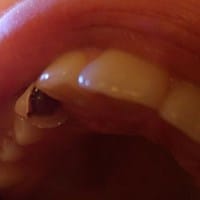 ¿Algún dentista me puede decir que es esto?