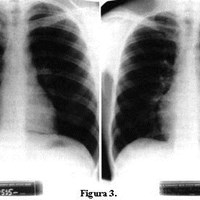 ¿Qué hacer si me he estancado en el gimnasio?