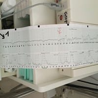 Interpretación de un electro fetal