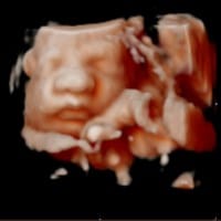 Aterrada... ¿Alguien qué tenga conocimiento en ecografías? Necesito aclarar mi duda :(