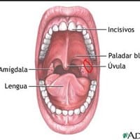 Herida dolorosa en la parte de atrás de la boca