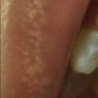 ¿Qué es esto que tengo en el labio?