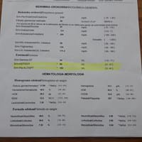 GPT ALTO , estoy muy preocupado