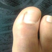 Me Luxe El Dedo GORDO del pie derecho