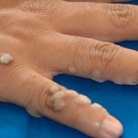 Quitar mezquinos de la mano