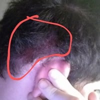 Que es lo que me pasa en mi pelo?
