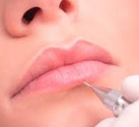 Ayuda con tratamiento láser de manchas oscuras en pómulos, bigote, nariz y cejas