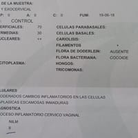 Dolor durante relación sexual después de terminar tratamiento por inflamación cérvico vaginal