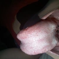 Que tengo en la lengua y la boca estoy preocupado que opinan