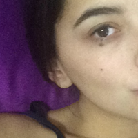 ¿Puedo fumar después de que me sacaron un lunar?