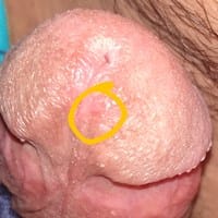 Glande reseco y brilliso, ¿Qué puedo usar?