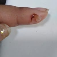 Flujo vaginal raro y retraso menstrual