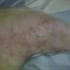 virsasa1