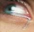 solitaria_29