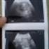 Jose Gregorio Antequera